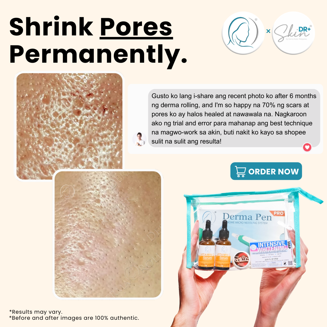 Derma Pen™