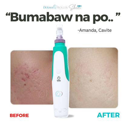 Derma Pen™ [PRE-ORDER]