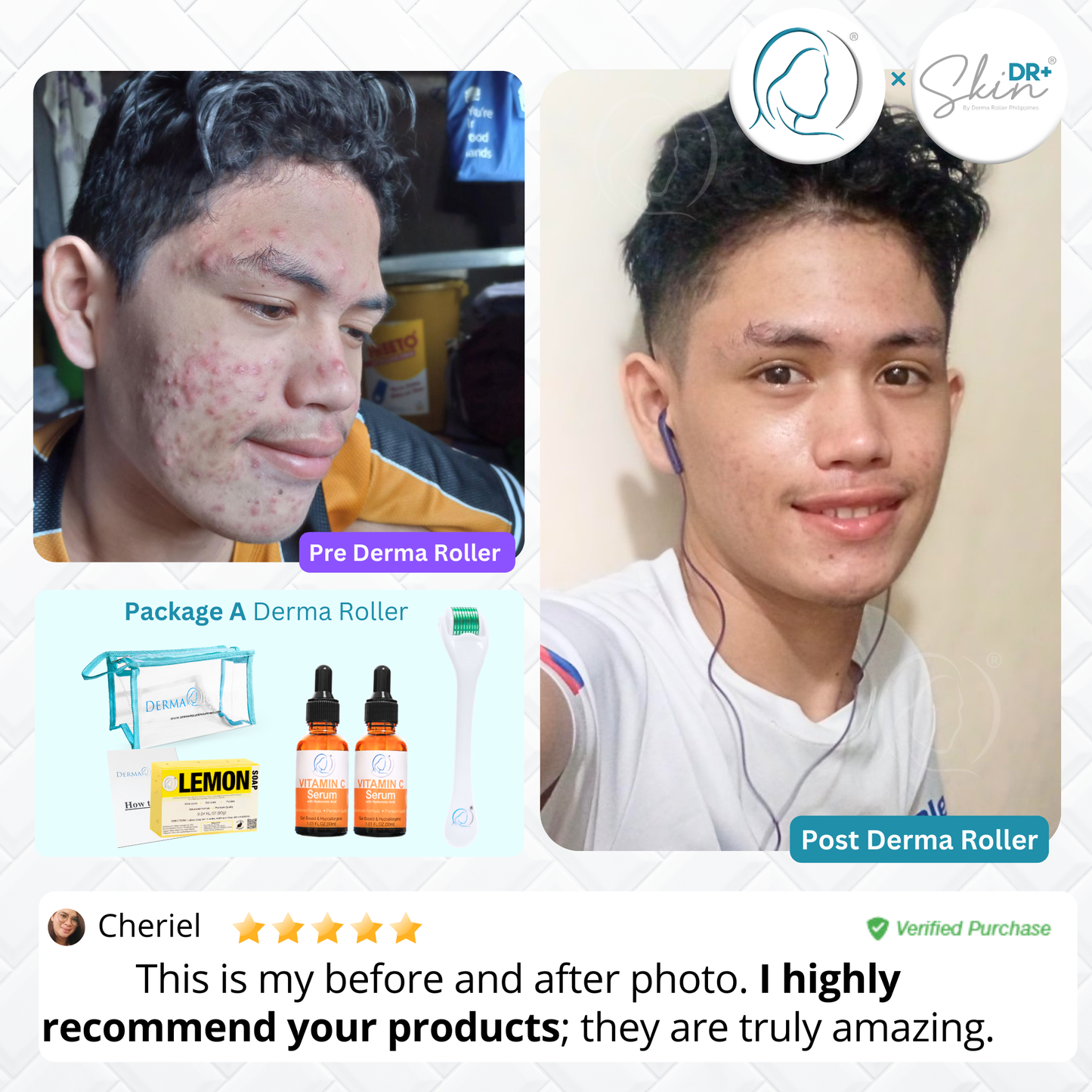 Derma Roller - Package A
