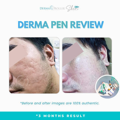 Derma Pen™ [PRE-ORDER]