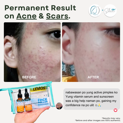 Derma Roller - Package A