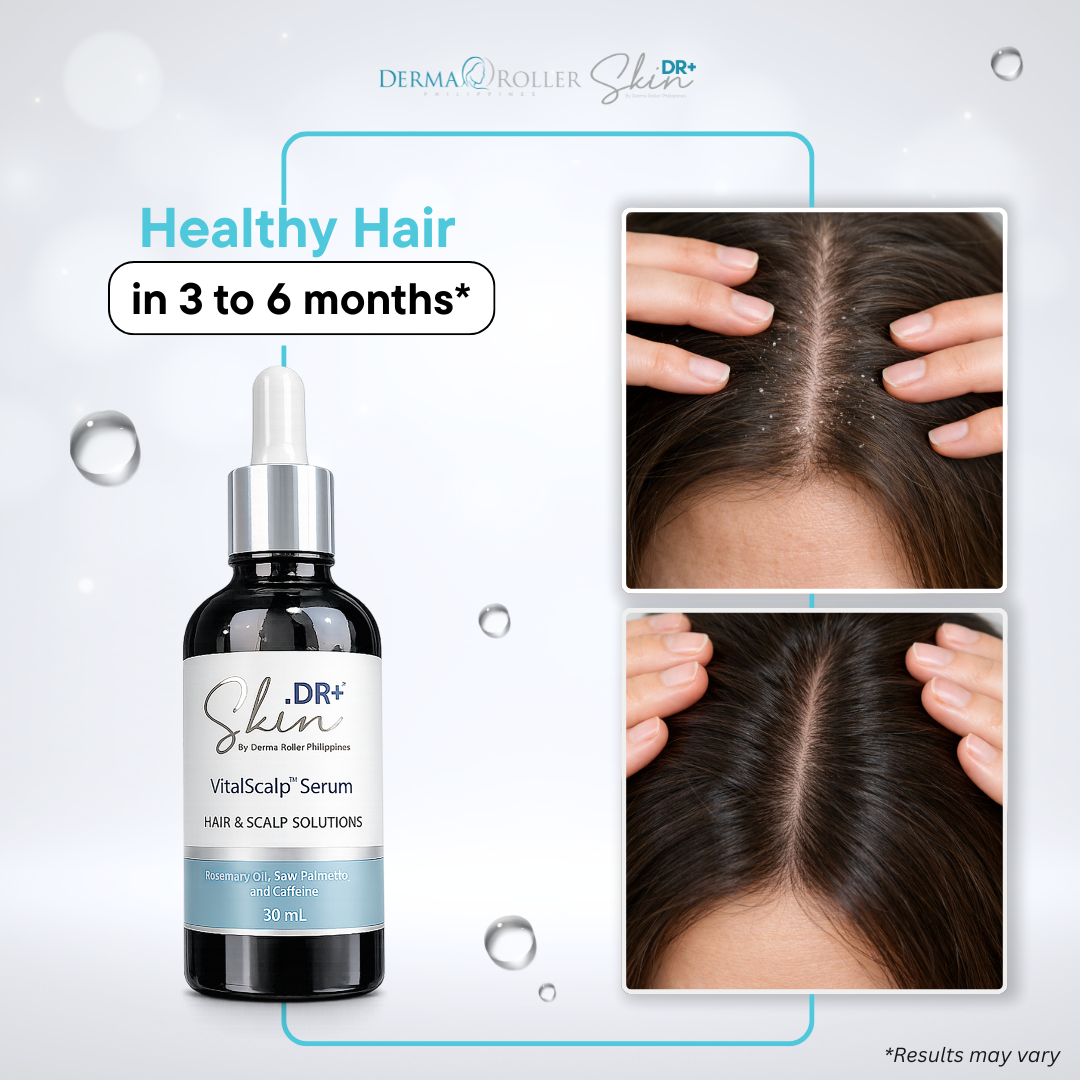 [NEW] VitalScalp™  Hair and Scalp Serum 30ml with Rosemary Oil + Saw Palmetto Extract + Caffeine