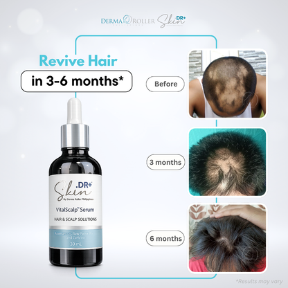 [NEW] VitalScalp™  Hair and Scalp Serum 30ml with Rosemary Oil + Saw Palmetto Extract + Caffeine