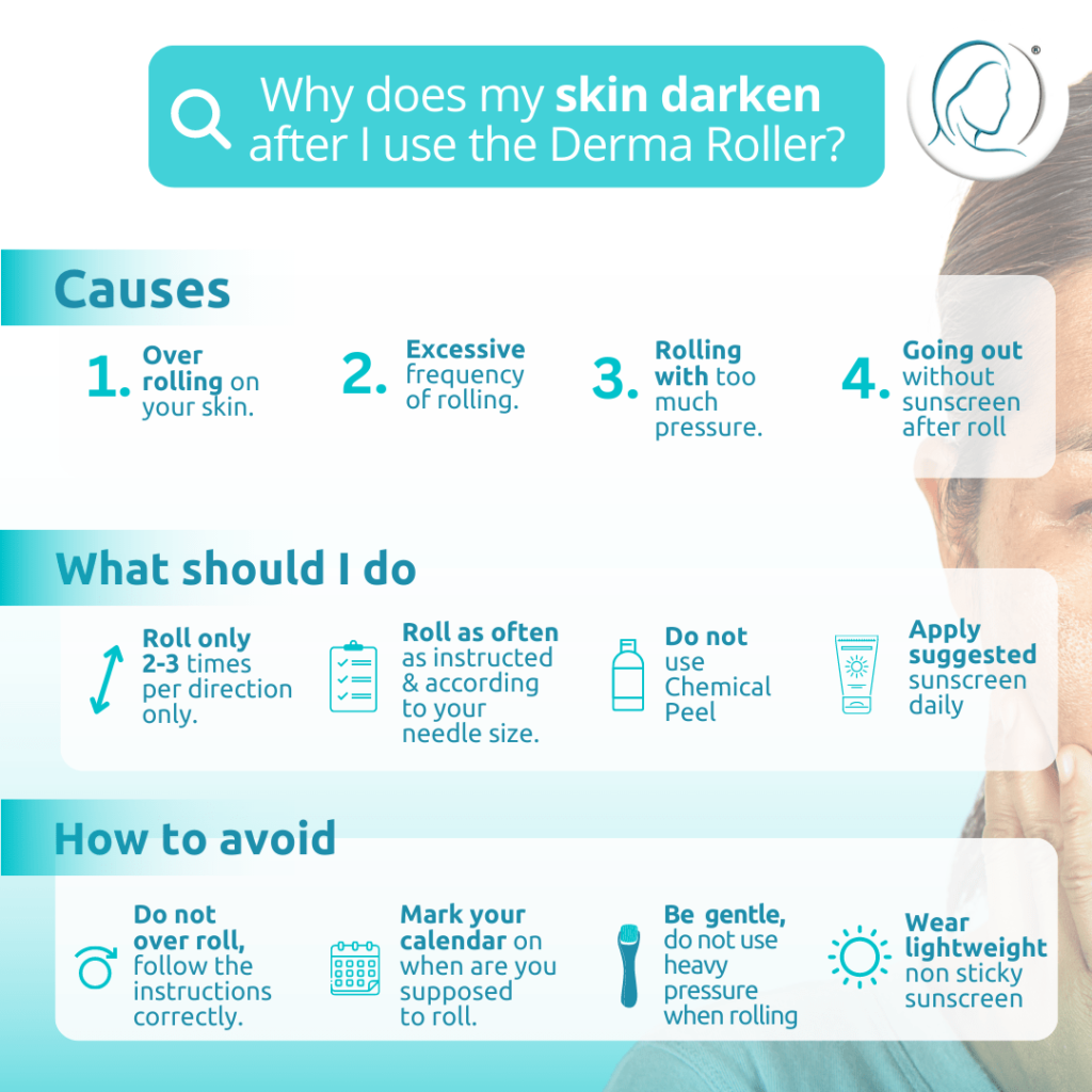 why does microneedling darken my skin-min